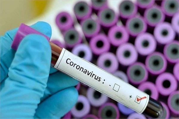 گزارش عملکرد معاونت تحقیقات و فناوری وزارت بهداشت، درمان و آموزش پزشکی در اپیدمی ویروس کورونا